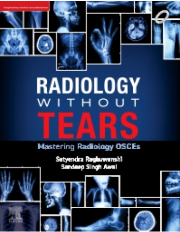 Radiology Without Tears Mastering Radiology OSCEs
